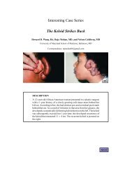 Interesting Case Series The Keloid Strikes Back - ePlasty