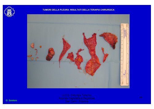 Mesotelioma pleurico. Trattamento chirurgico.pdf - Ospedale San ...