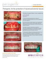 Surgical Esthetic Crown Lengthening - New Line Medical