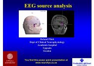 EEG source analysis.pdf - Clinical Neurophysiology