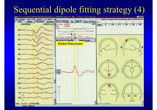 EEG source analysis.pdf - Clinical Neurophysiology