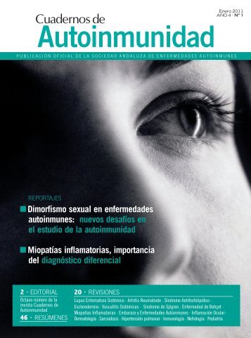 Dimorfismo sexual en enfermedades autoinmunes - IbÃ¡Ã±ez&Plaza ...