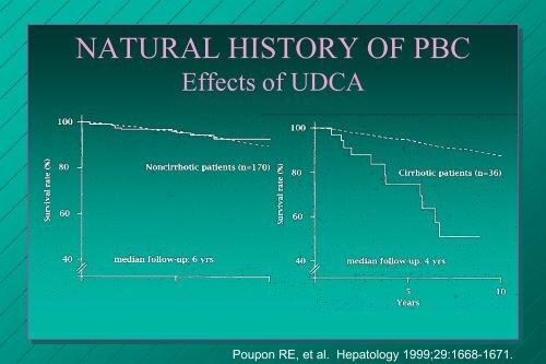 URSODIOL FOR PRIMARY BILIARY CIRRHOSIS - AASLD