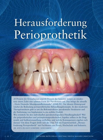 Perioprothetik - praxis-hc.de