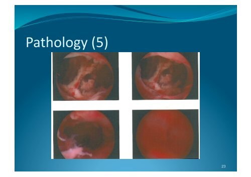 Veress J. Neues Instrument sur Ausfuhrung von ... - Dr Philip Thomas