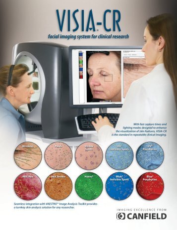 brochure VISIA-CR - Canfield Scientific Inc