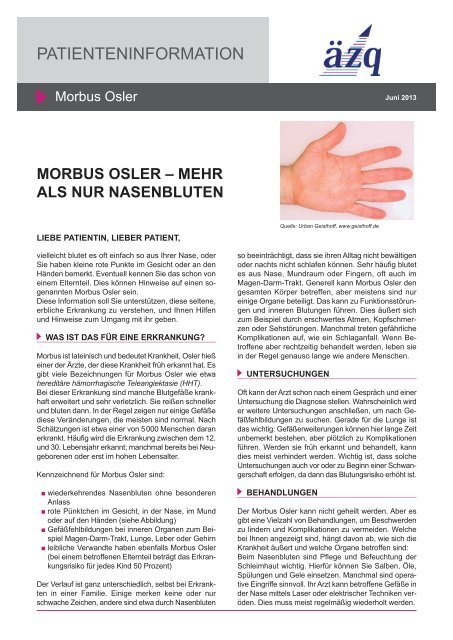 Kurzinformation "Morbus Osler - Patienten-Information.de