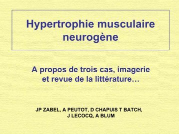 Hypertrophie musculaire neurogÃ¨ne