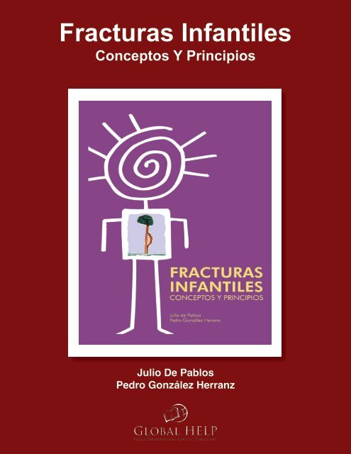 Fracturas Infantiles: Conceptos Y Principios - Global HELP