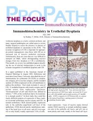 Immunohistochemistry in Urothelial Dysplasia - IHC World