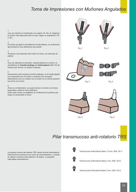 CatÃ¡logo de implantes TRS - Dentalraces