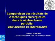 Nephrectomie partielle comparaison voie ouverte/laparoscopique