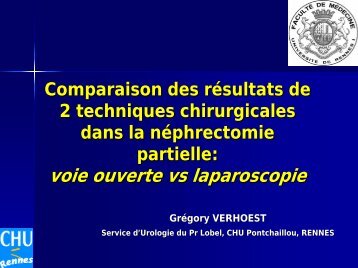 Nephrectomie partielle comparaison voie ouverte/laparoscopique