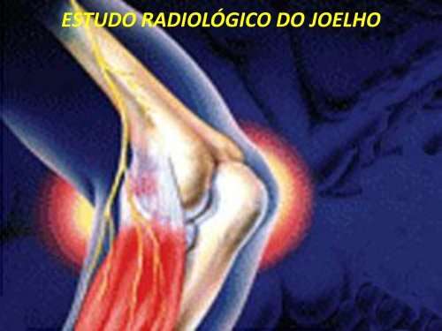 ESTUDO RADIOLÃGICO DO JOELHO - Comunidades