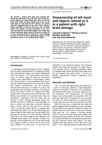 Disownership of left hand and objects related to it in a patient with ...