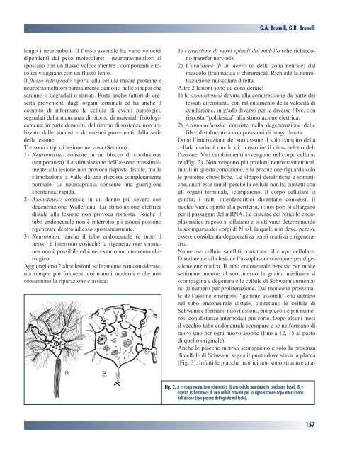 La fisiopatologia della riparazione e rigenerazione nervosa