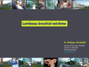 Lambeau brachial extrÃªme - e-plastic.fr