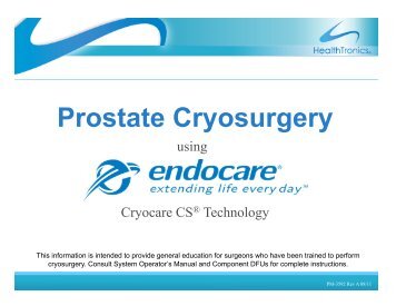 Prostate Cryosurgery - Healthtronics
