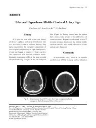 Bilateral Hyperdense Middle Cerebral Artery Sign