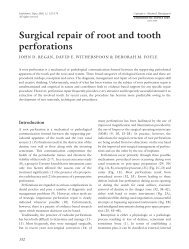 Surgical repair of root and tooth perforations - Wiley Online Library