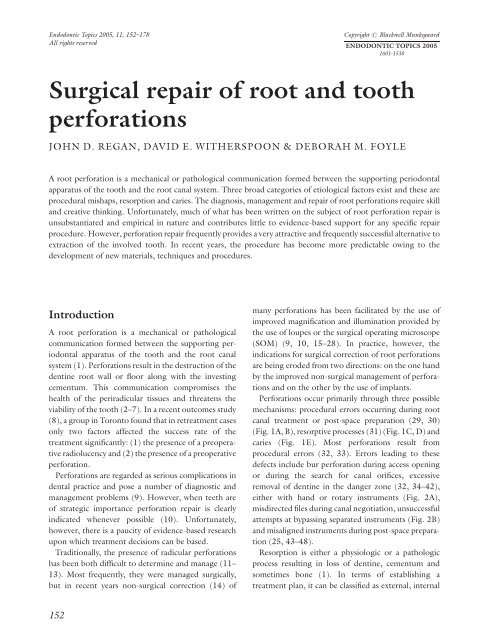 Surgical repair of root and tooth perforations - Wiley Online Library