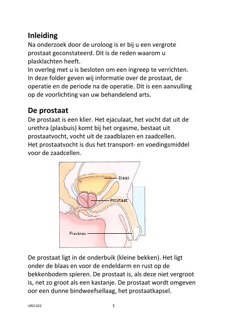 Prostaatoperatie: TUR - IJsselland Ziekenhuis