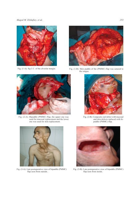 Continuous Validity of Pedicled Myocutaneous and Myofascial ... - NCI