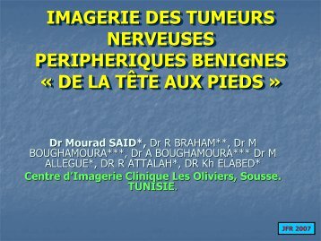 IMAGERIE DES TUMEURS NERVEUSES PERIPHERIQUES ...