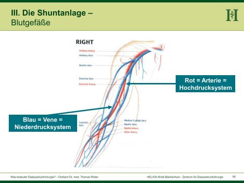 Vortrag (PDF-Datei) - Shunt