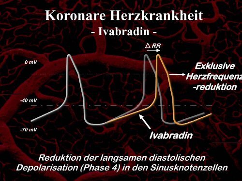 RefraktÃ¤re Angina Pectoris - Certkom