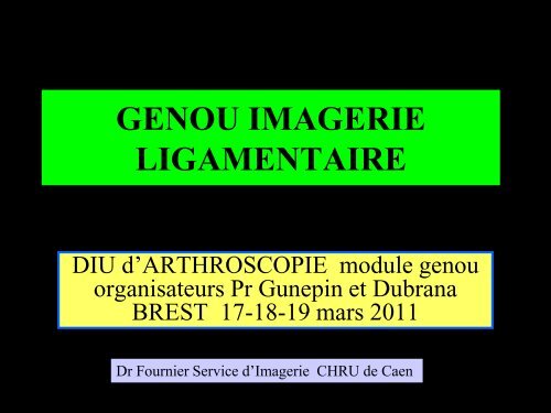 GENOU IMAGERIE LIGAMENTAIRE