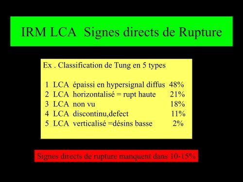 GENOU IMAGERIE LIGAMENTAIRE