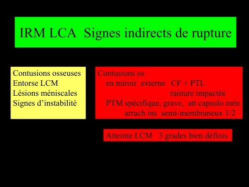GENOU IMAGERIE LIGAMENTAIRE