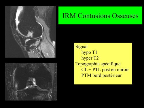 GENOU IMAGERIE LIGAMENTAIRE