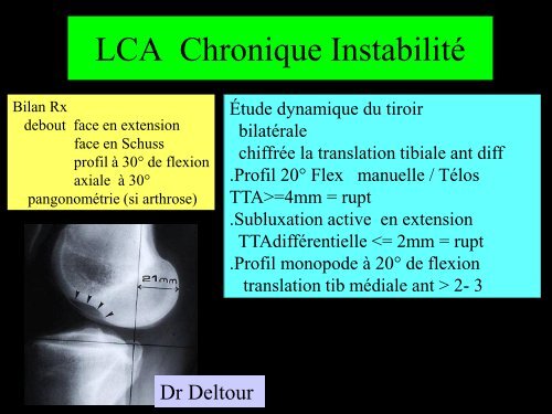 GENOU IMAGERIE LIGAMENTAIRE