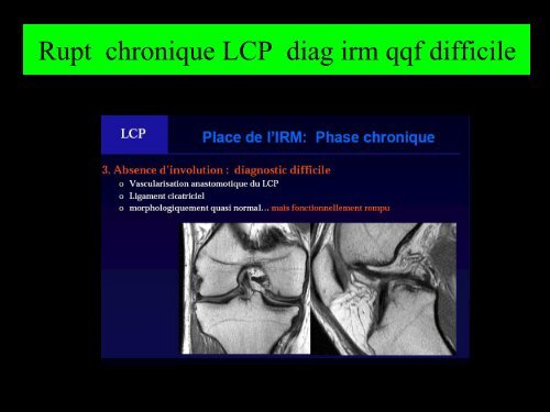 GENOU IMAGERIE LIGAMENTAIRE