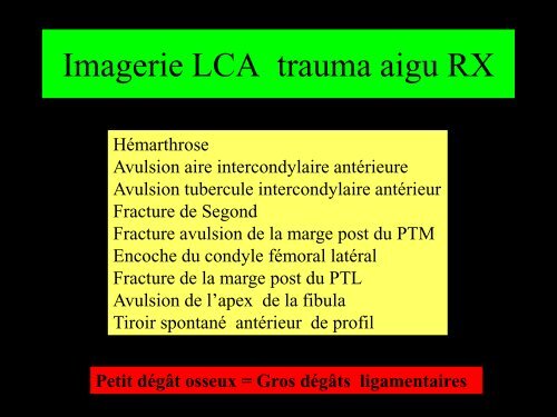 GENOU IMAGERIE LIGAMENTAIRE