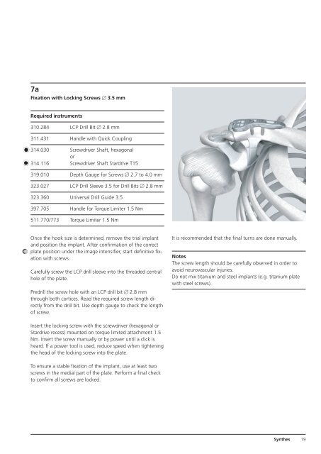 LCP Clavicle Hook Plate. The fixation system with ... - Osteosyntese