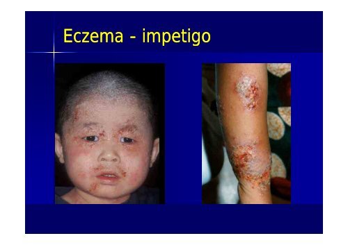 Common Skin Lesions in Infants