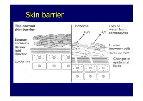 Common Skin Lesions in Infants