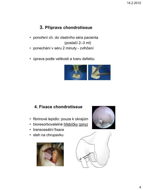 Chondrotissue - Přednáška - Mikulov - SSTA