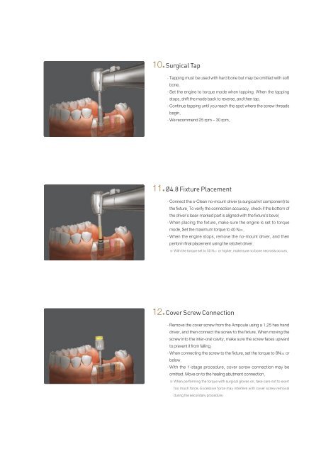 Surgical Manual - Implant Supply