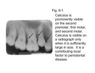 Fig. 6-1 Calculus is prominently visible on the second premolar, first ...