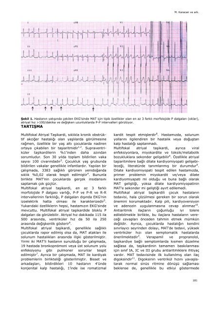 Multifokal Atriyal Taşikardi: Bir Olgu - Yeni Tıp Dergisi