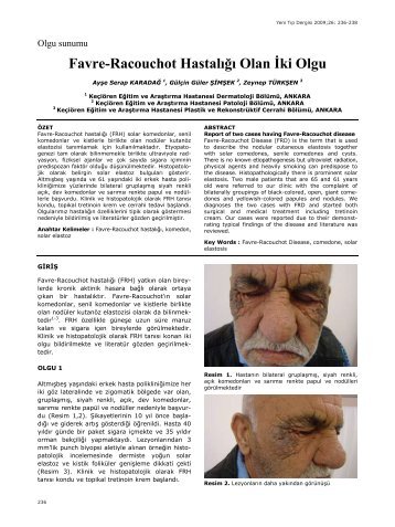 Favre-Racouchot Hastalığı Olan İki Olgu - Yeni Tıp Dergisi