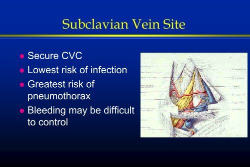 Central Venous Catheterization - VCU Internal Medicine Electronic ...