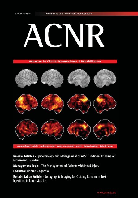 Download - Advances in Clinical Neuroscience and Rehabilitation