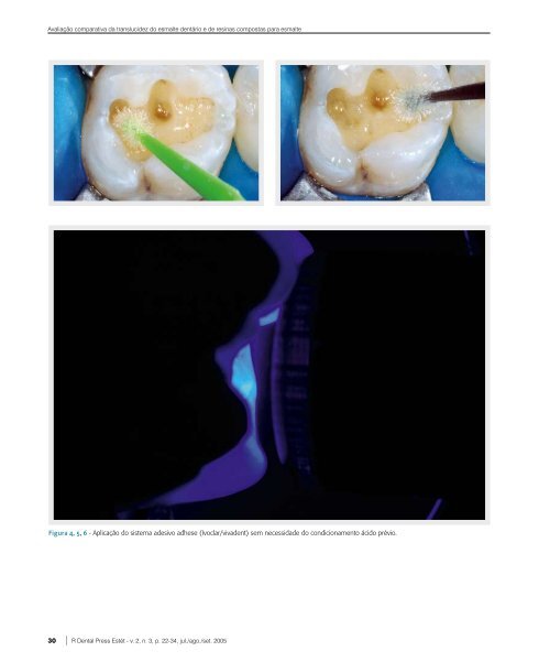 Avaliação comparativa da translucidez do esmalte dentário e de ...
