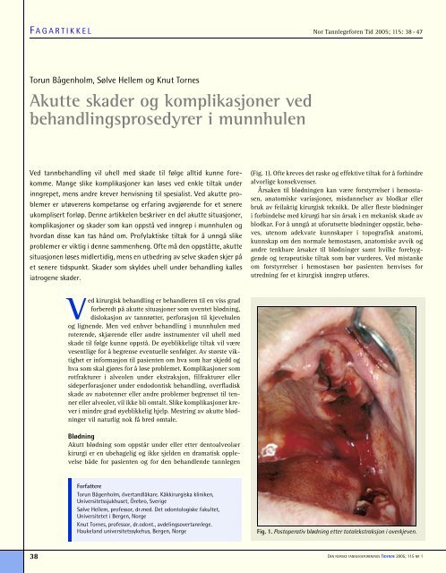 Akutte skader og komplikasjoner ved behandlingsprosedyrer i ...