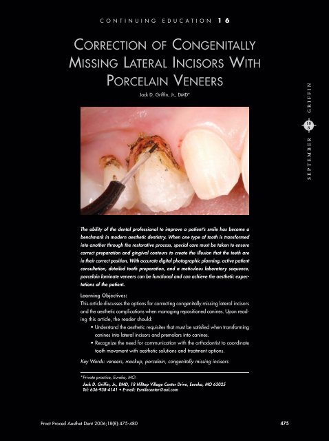 Correction of Congenitally Missing Lateral Incisors with Porcelain